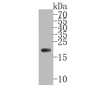 Ferritin Heavy Chain Antibody