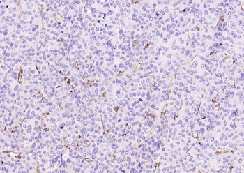 CD206 Antibody