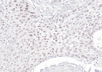 p63 Antibody