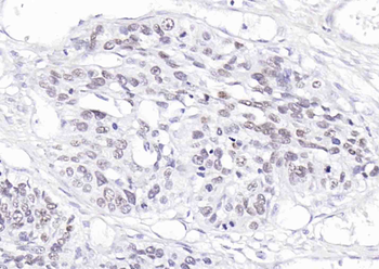 p63 Antibody