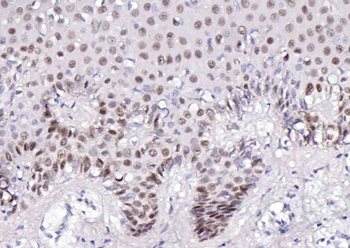 p63 Antibody