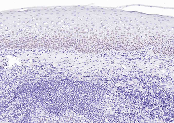 p63 Antibody