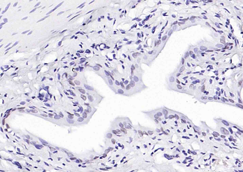 p63 Antibody