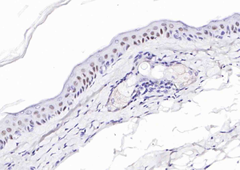 p63 Antibody