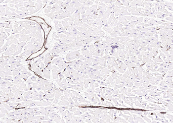 CD39/ENTPD1 Recombinant Rabbit Monoclonal Antibody