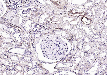 CD39/ENTPD1 Antibody