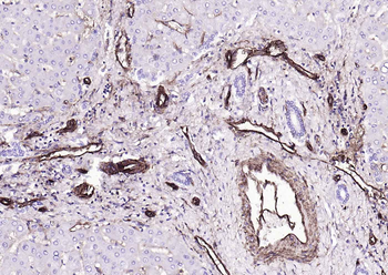 CD39/ENTPD1 Antibody