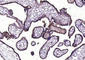 CD39/ENTPD1 Antibody