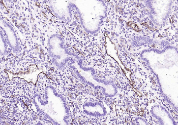 CD39/ENTPD1 Antibody