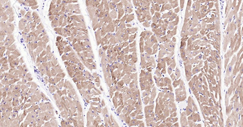 MYH6 Antibody