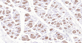 MYH6 Antibody