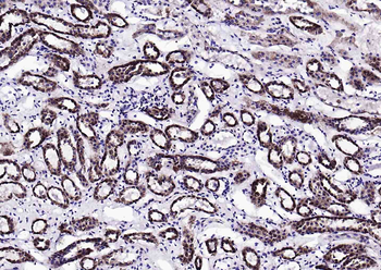 S100A10 antibody