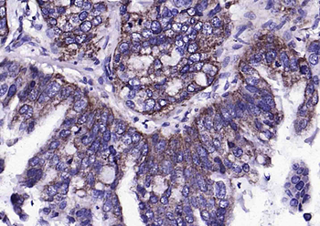 S100A10 antibody