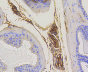 RAB5A Antibody