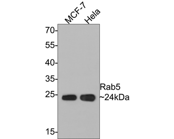 RAB5A Antibody