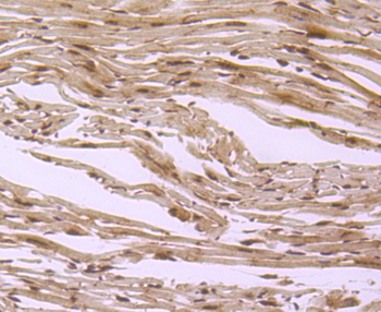 S1PR1 Antibody