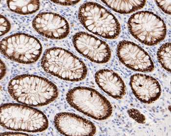 CDX2 Antibody