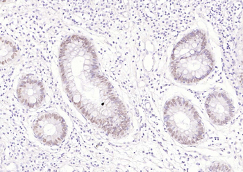 CDX2 Antibody