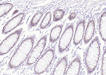 CDX2 Antibody