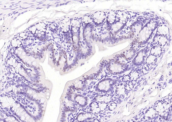 CDX2 Antibody