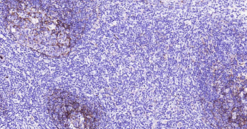 ITGAM Antibody