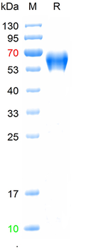 Recombinant Bovine Pregnancy-associated glycoprotein 1 (HEK293)