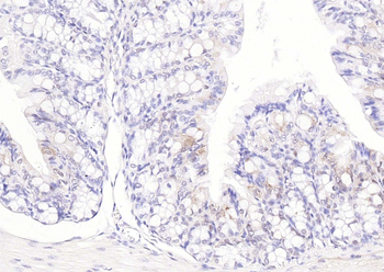 SOD1 Antibody