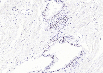 TARDBP Antibody