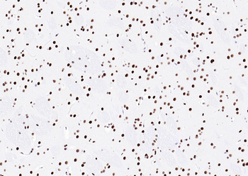 TARDBP Antibody