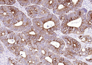 KRT8 Antibody