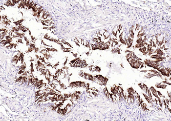 KRT8 Antibody