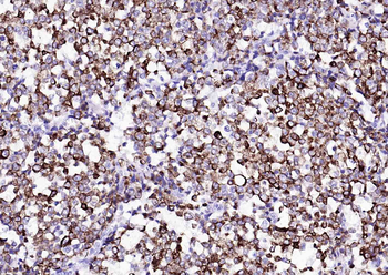 KRT8 Antibody