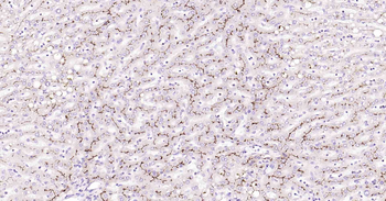 ABCB1 Antibody