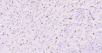 ABCB1 Antibody