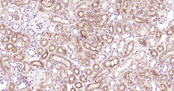 ABCB1 Antibody