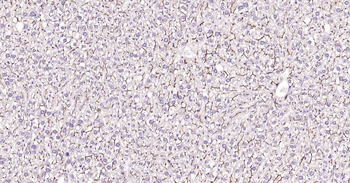 ABCB1 Antibody