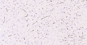 ABCB1 Antibody