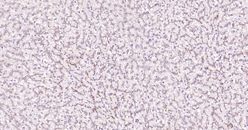 ABCB1 Antibody