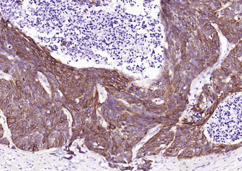 KRT14 Antibody