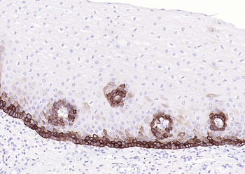 KRT14 Antibody