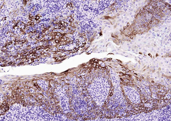 KRT14 Antibody