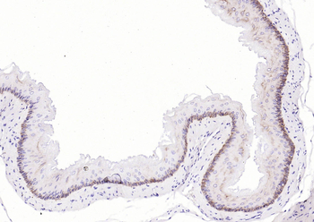 KRT14 Antibody