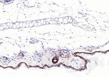 KRT14 Antibody