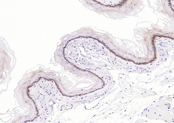 KRT14 Antibody