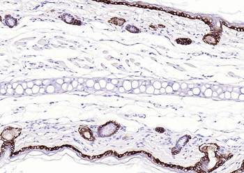 KRT14 Antibody