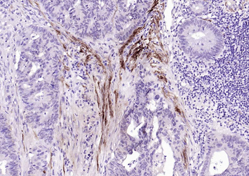 MYH11 Antibody