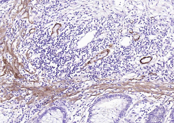 MYH11 Antibody