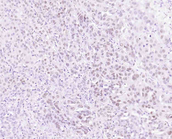 TP53 Antibody