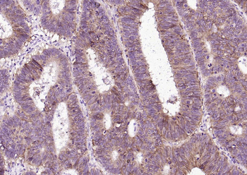 EPCAM Antibody