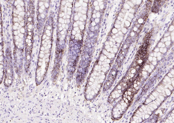 EPCAM Antibody